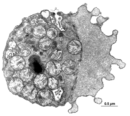 cross section of a worm spermatozoa